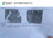 凤凰彩票高层论坛-上海迪康医学生物技术有限公司和大连国科恒泰医疗科技有限公司中标大连市第七人民医院登峰计划项目医疗设备采购项目