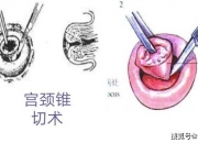 8号彩票大厅-爱尔眼科最新公告：拟8.98亿元收购35家医院部分股权