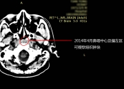 下载109cc彩票-医疗装备国家级赛事瞄准“关键核心技术”