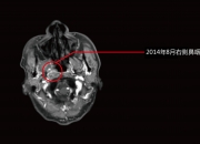 外商独资医院来华 带来哪些变化？专家详解