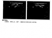 午评：沪指跌0.92% 医疗服务板块涨幅靠前