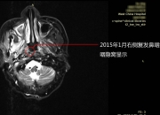 福建9月1日起将辅助生殖纳入医保