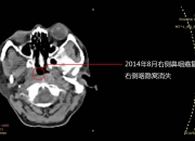 彩票1288福天堂网址-成功案例 | 成者会议星助力华中科技大学同济医院开启智能办公新时代！