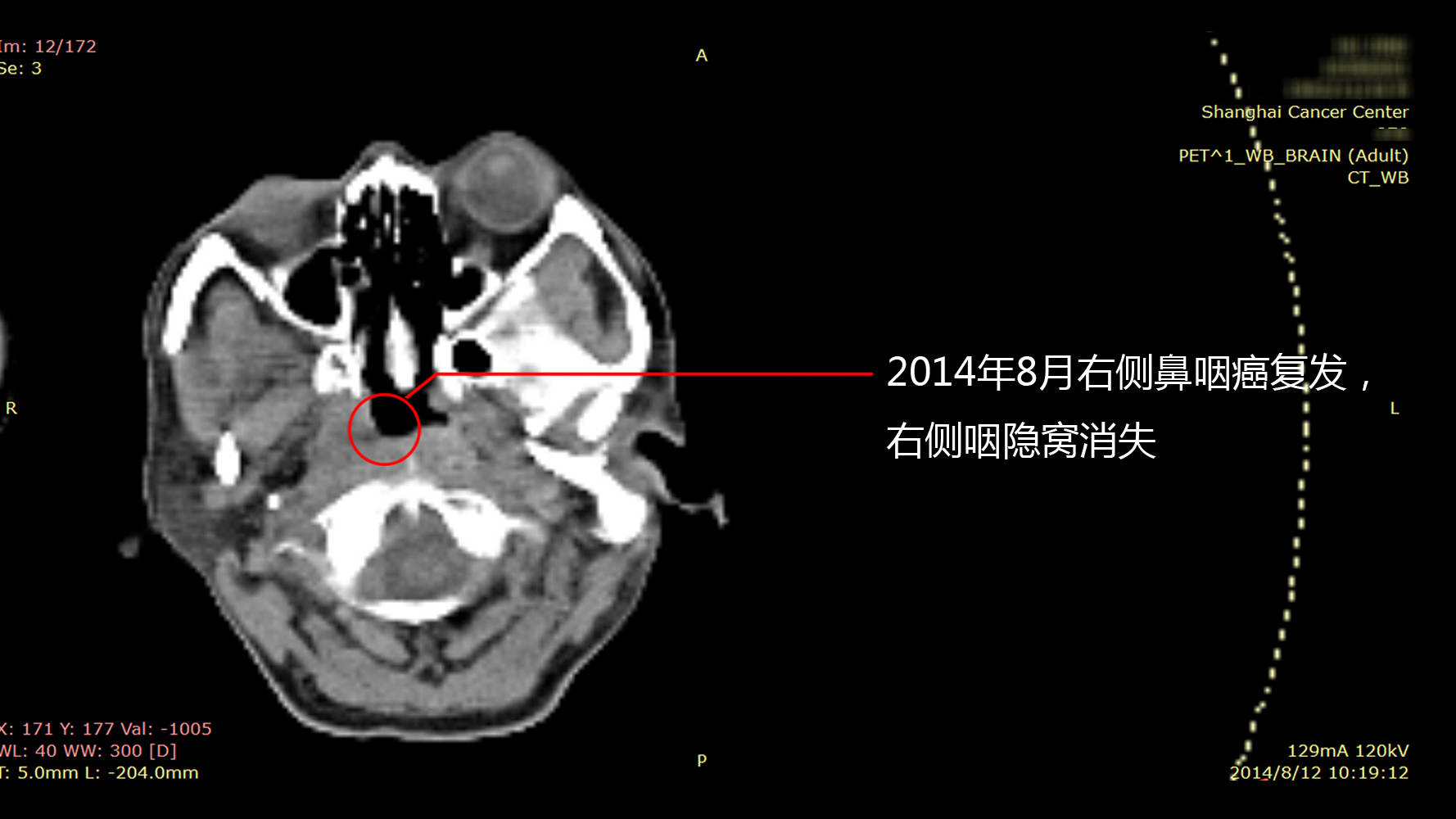 彩票1288福天堂网址-成功案例 | 成者会议星助力华中科技大学同济医院开启智能办公新时代！