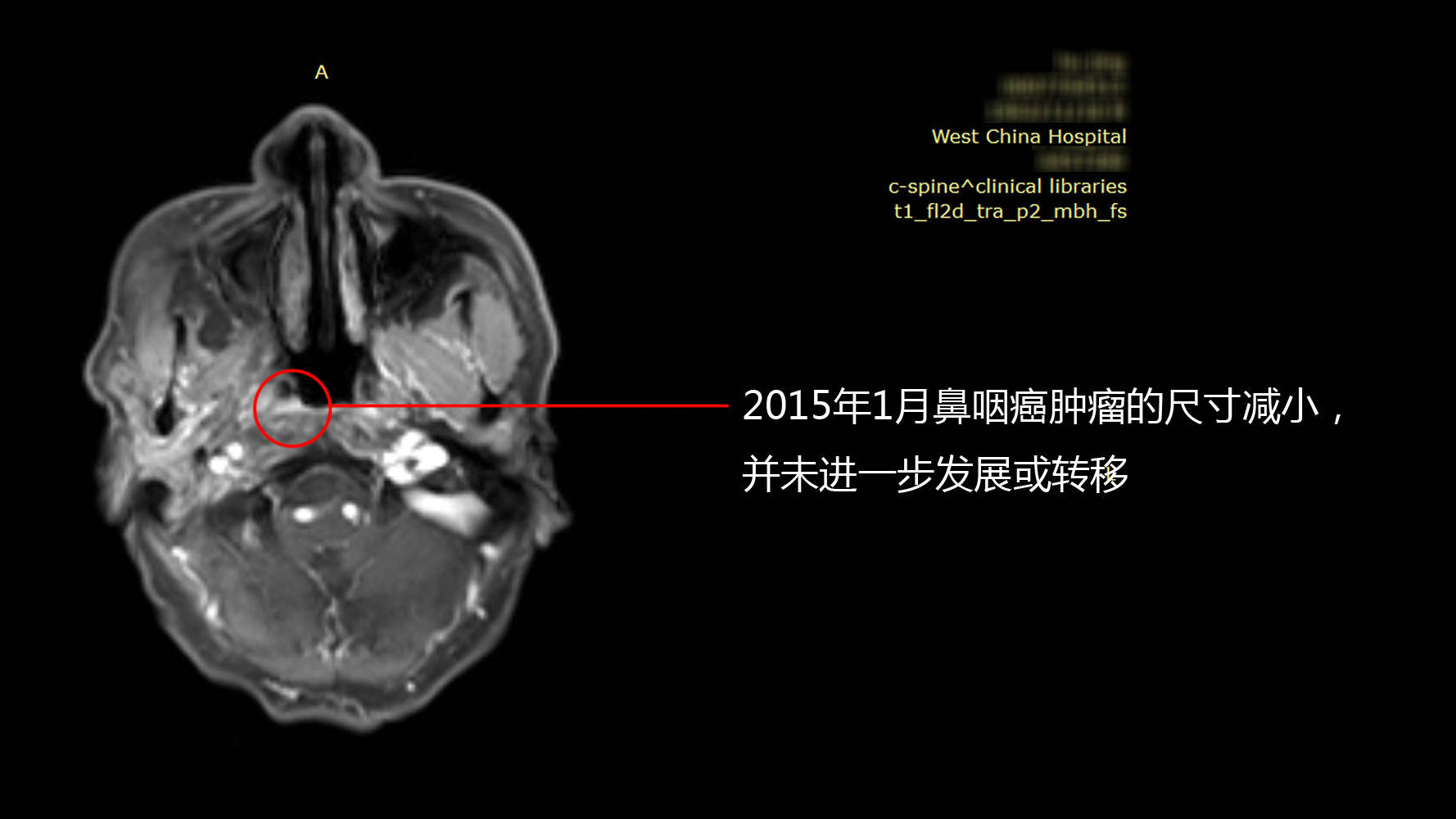 kk体育app官网-家乡话 说变化丨在保定就能看北京名医，着（zháo）好！