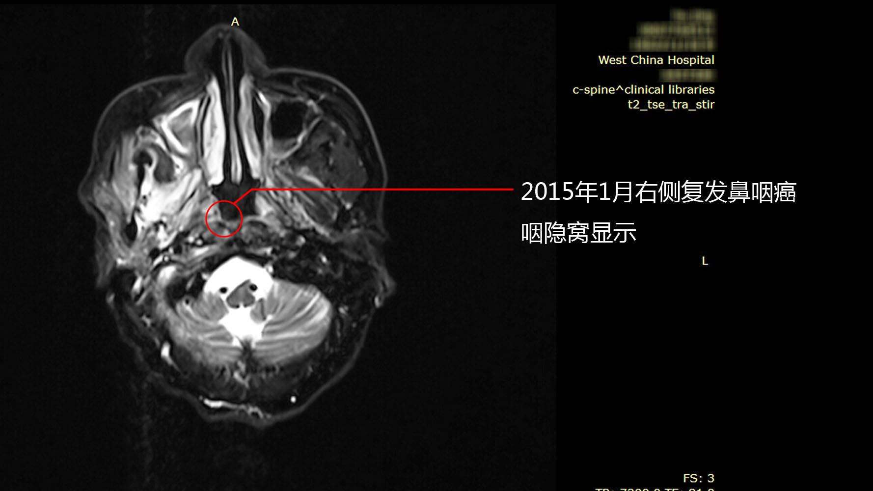 福建9月1日起将辅助生殖纳入医保