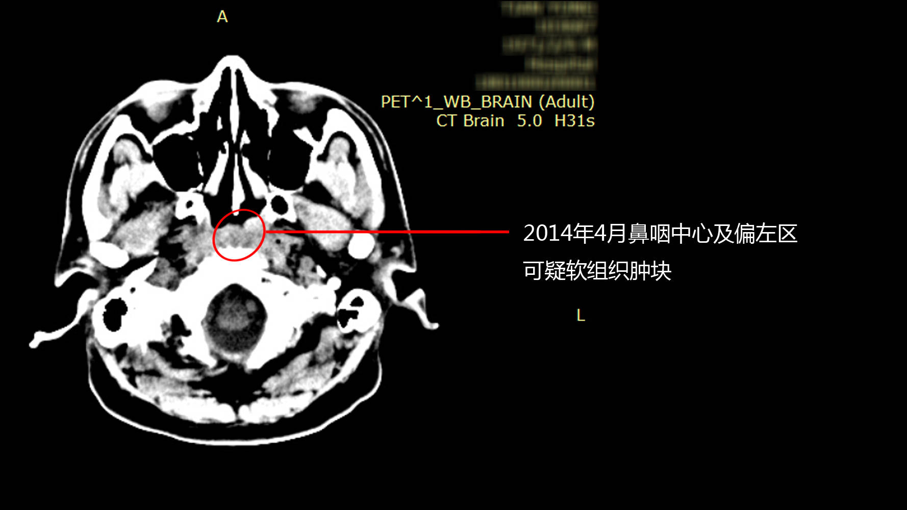 下载109cc彩票-医疗装备国家级赛事瞄准“关键核心技术”