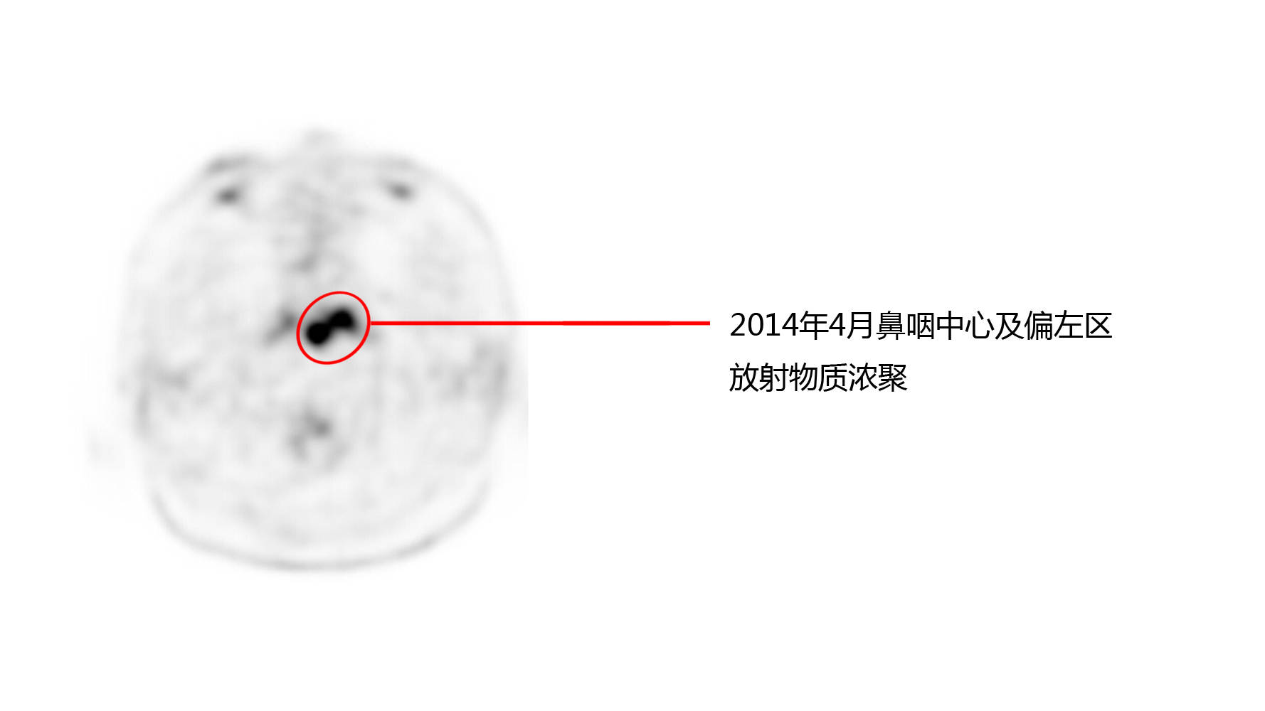 c7电子麻将胡了-创新医疗管理股份有限公司关于建华医院公司 与前海卓越相关诉讼的进展公告