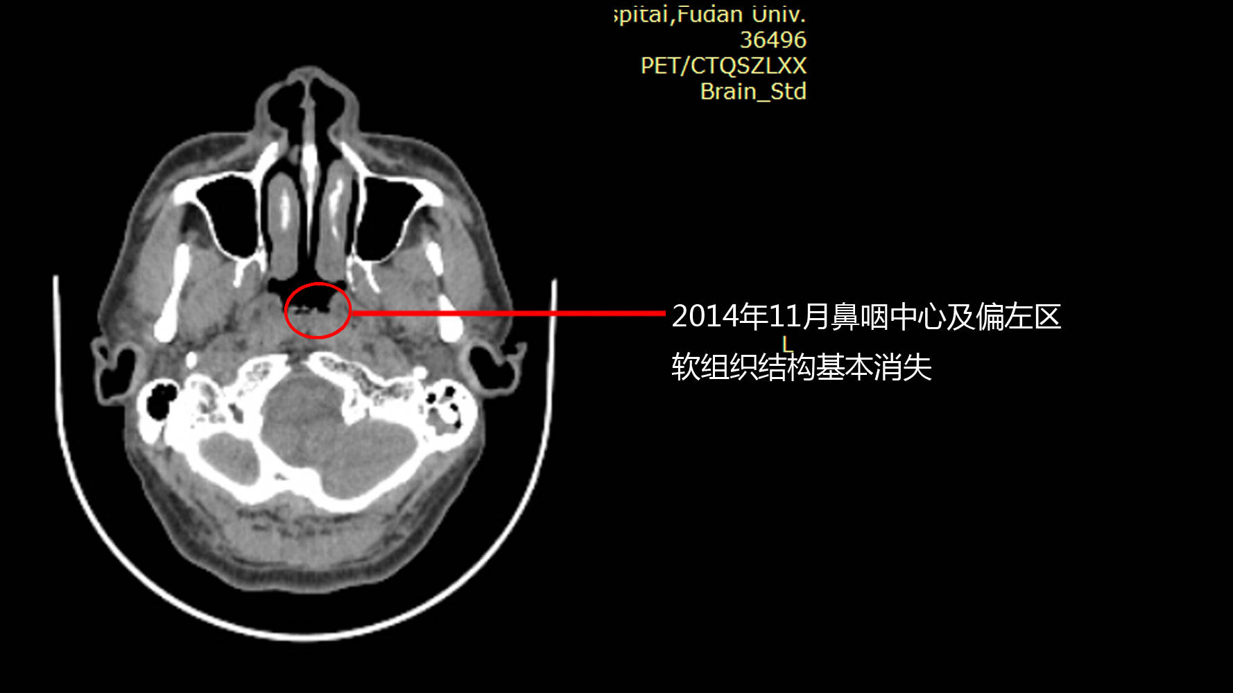 sky娱乐在线登录-中工网评丨坚决斩断伸向国家医保基金的“黑手”！