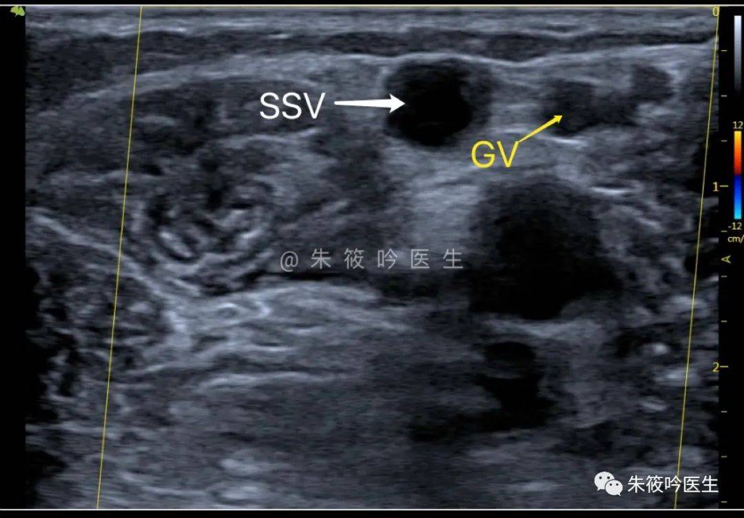 长春做近视眼手术医院排名?汇总五家医院资料!