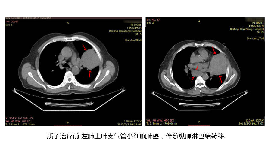 迪祥斗地主-基因检测报销视地方和医保财力，国家卫健委称尚难全面进医保