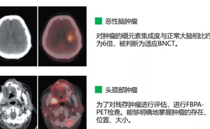 澧县医保政策宣讲深入民心，居民点赞新政策实惠